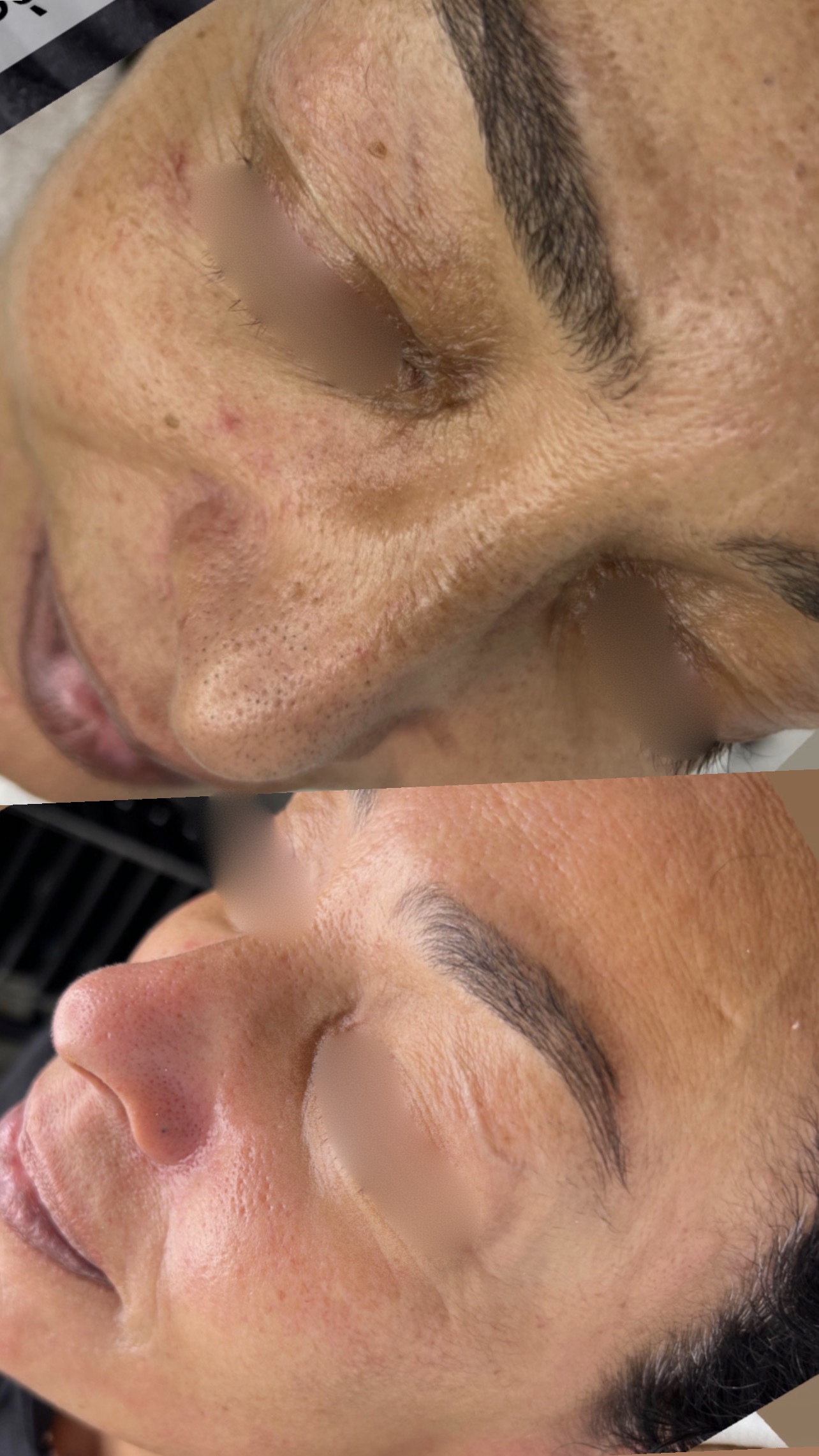 HYDRAFACE SKIN